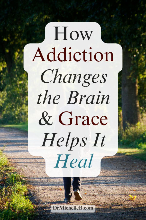 Addiction can reshape the brain’s reward system, emotional regulation, and ability to make healthy decisions. But through neuroplasticity, truth, compassion, supportive relationships, and God’s grace, healing remains possible. Learn how the brain can build healthier pathways and why lasting recovery requires both accountability and grace.